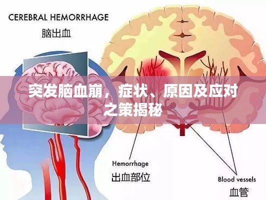 张弓拔弩 第2页