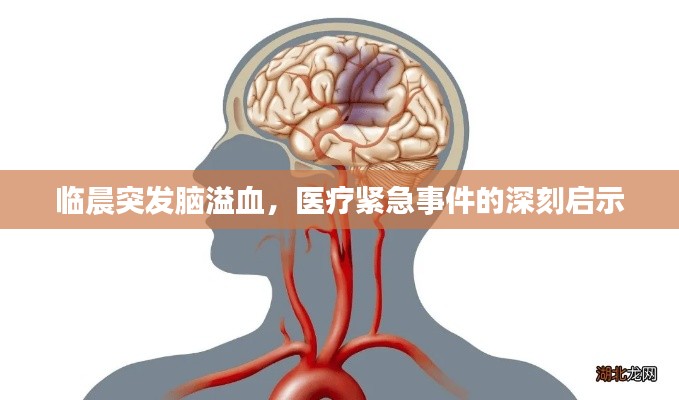 临晨突发脑溢血,医疗紧急事件的深刻启示